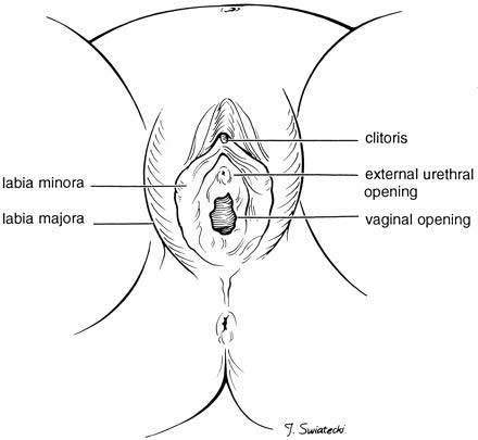Excision du prépuce, avec ou sans excision partielle ou totale du clitoris