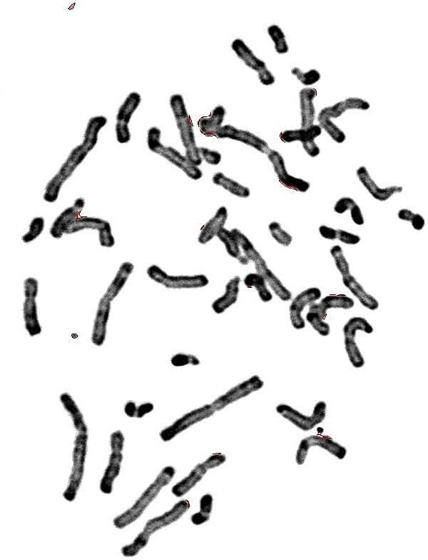 Chromosomes métaphasiques d'un noyau cellulaire éclaté et dispersé 