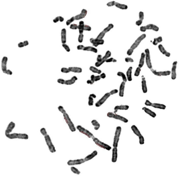 Chromosomes métaphasiques d'un noyau cellulaire éclaté et dispersé