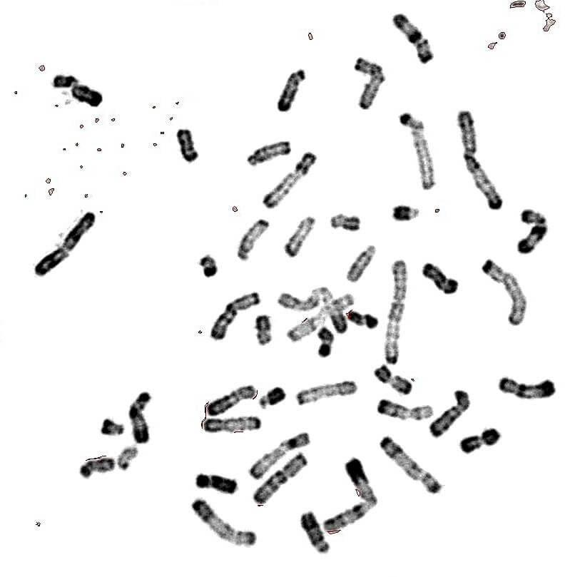 Chromosomes métaphasiques d'un noyau cellulaire éclaté et dispersé 