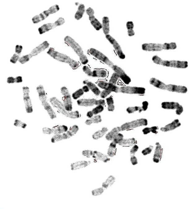 Chromosomes métaphasiques d'un noyau cellulaire éclaté et dispersé
