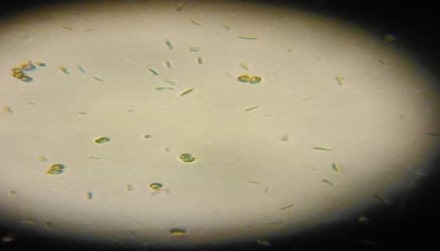 observation microscopique des micro-algues (endroit 1) GX10 Genres : Asterococcus, Diatoma