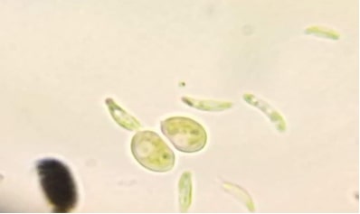 observation microscopique des micro-algues (A) GX100 Genres Eutonia, Diatoma, Asterococcus