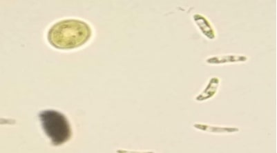 observation microscopique des micro-algues (B) GX100 Genres Eutonia, Diatoma, Asterococcus