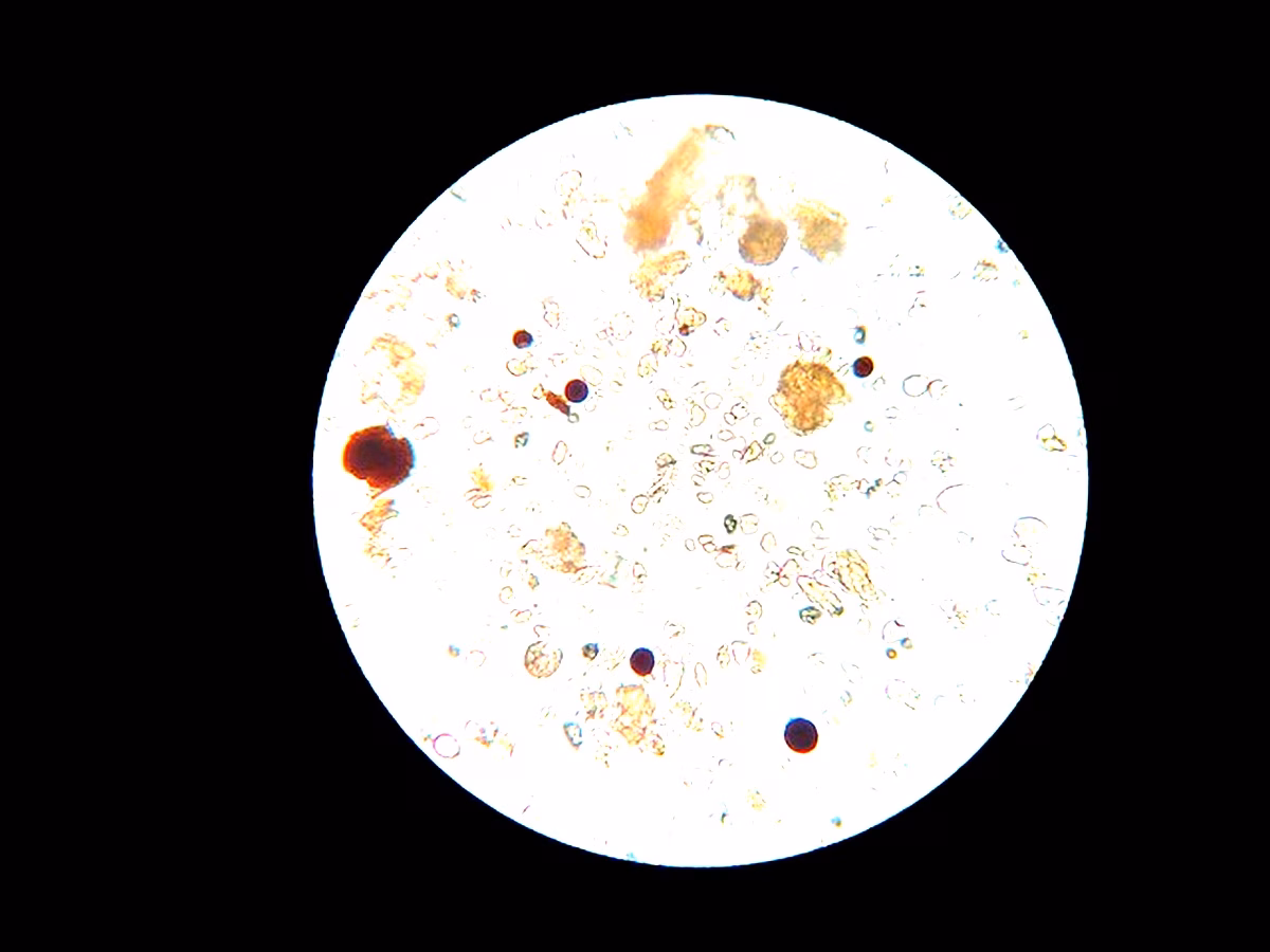 Staphylococcus et Streptococcus en Algérie : étude des zones humides
