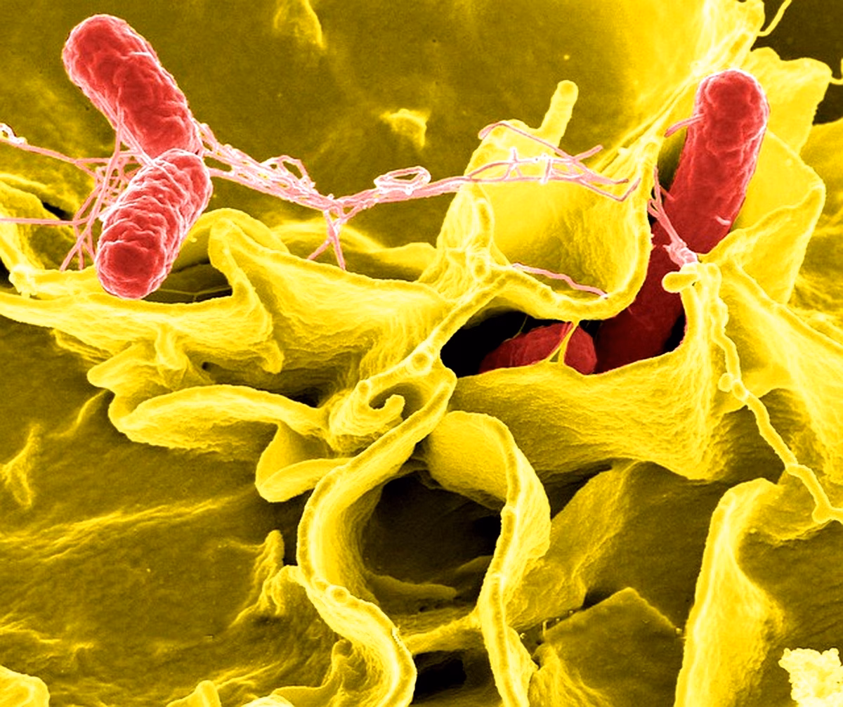 Antibiorésistance des entérobactéries : étude à Sétif