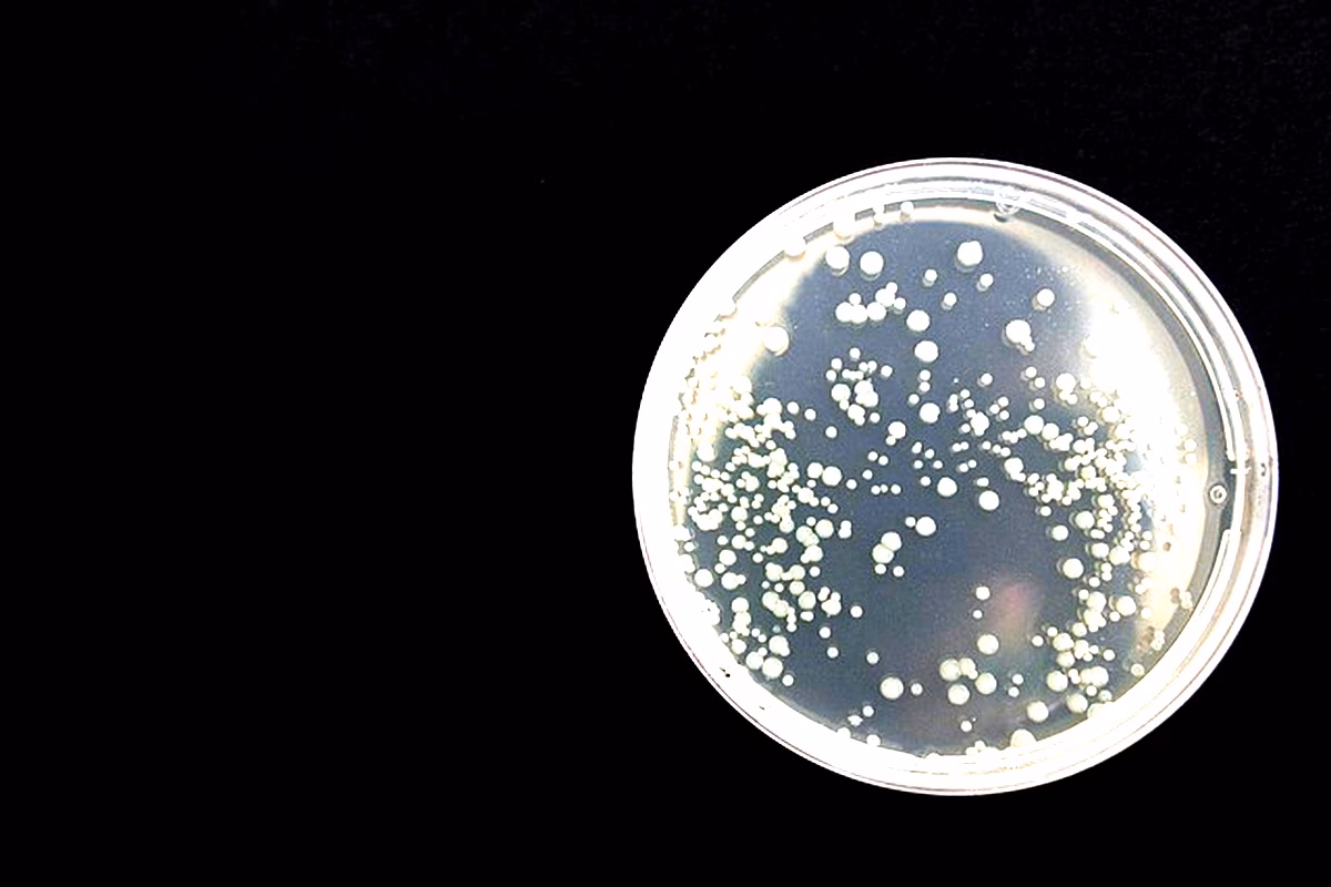 Pseudomonas en zones humides : étude en Algérie