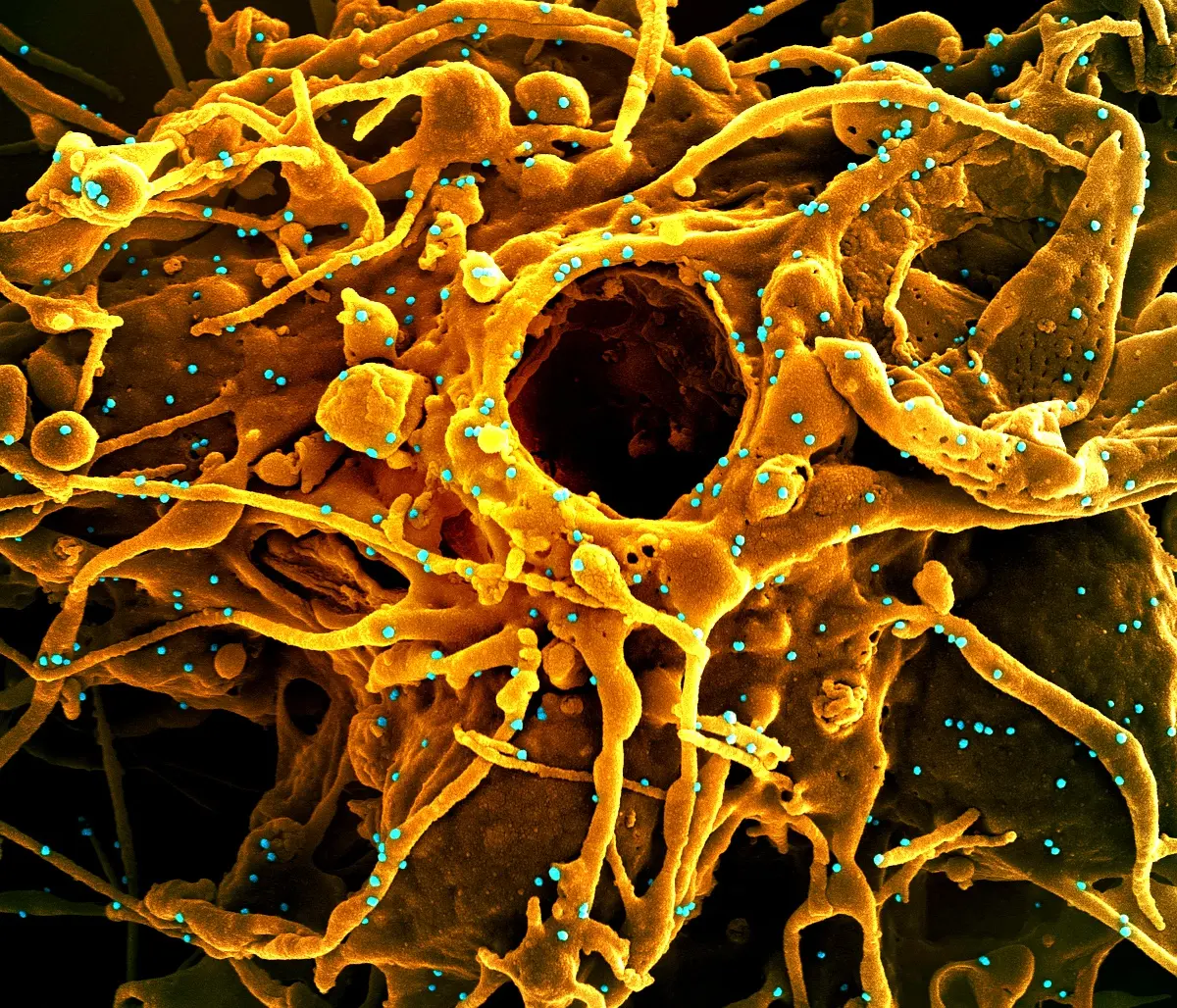 Stratégies d'implémentation du stress environnemental